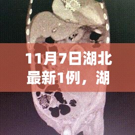 湖北新增病例解析与应对指南，从初学者到进阶用户的处理步骤解析（11月7日最新报告）