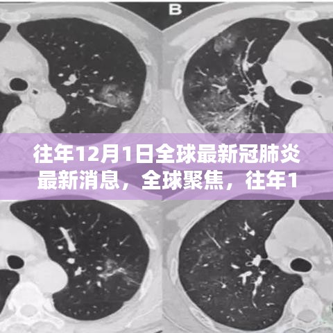 全球聚焦，往年12月1日新冠肺炎最新消息综述与观点阐述