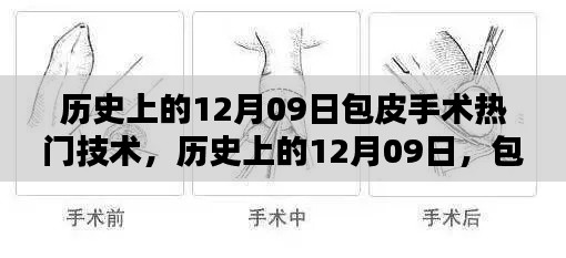 历史上的包皮手术革新里程碑，12月09日的手术技术革新回顾