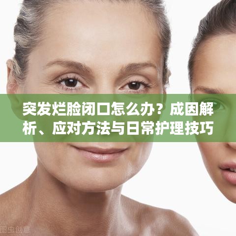 突发烂脸闭口怎么办？成因解析、应对方法与日常护理技巧