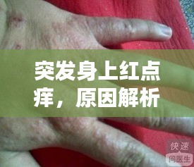 突发身上红点痒，原因解析及应对妙招