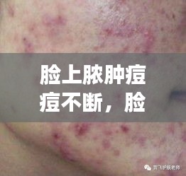 脸上脓肿痘痘不断，脸上脓包痘痘多久才好 