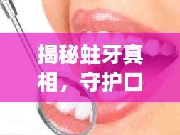 揭秘蛀牙真相，守护口腔健康专题片