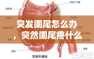 突发阑尾怎么办，突然阑尾疼什么原因 