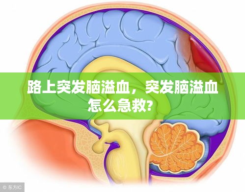 路上突发脑溢血，突发脑溢血怎么急救? 