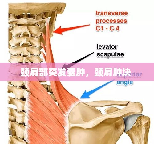 颈肩部突发囊肿，颈肩肿块 