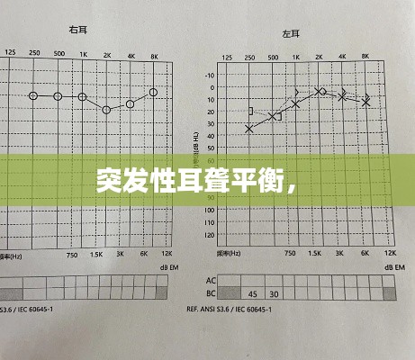 突发性耳聋平衡， 