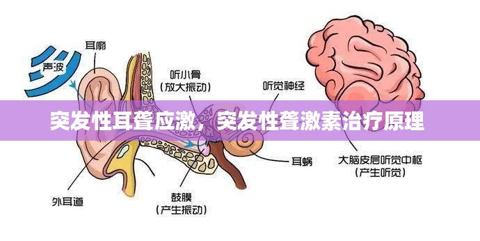 突发性耳聋应激，突发性聋激素治疗原理 