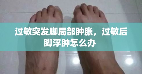 过敏突发脚局部肿胀，过敏后脚浮肿怎么办 