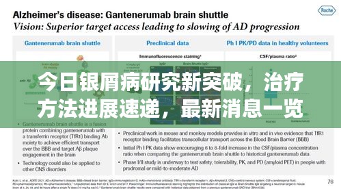 今日银屑病研究新突破，治疗方法进展速递，最新消息一览