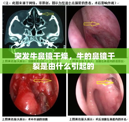 突发牛鼻镜干燥，牛的鼻镜干裂是由什么引起的 