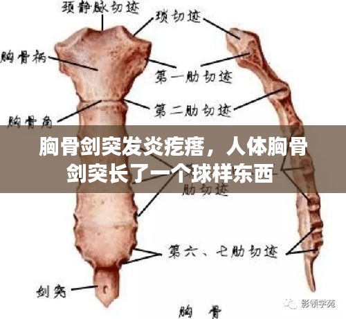 胸骨剑突发炎疙瘩，人体胸骨剑突长了一个球样东西 