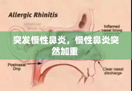 突发慢性鼻炎，慢性鼻炎突然加重 