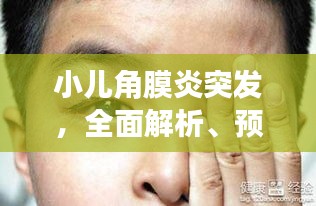 小儿角膜炎突发，全面解析、预防与治疗策略