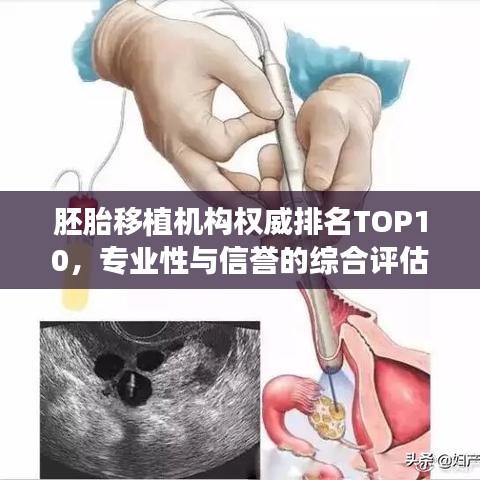 胚胎移植机构权威排名TOP10，专业性与信誉的综合评估榜单